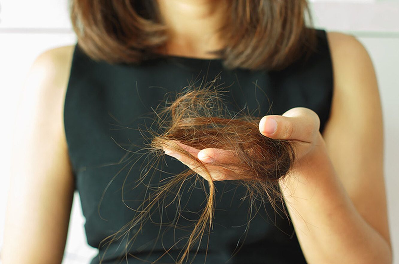 Что делать, если выпадают волосы: лечение женщин