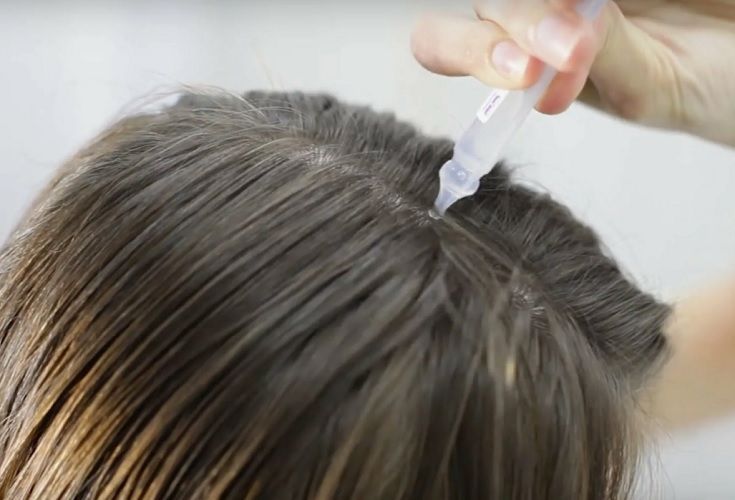 Основные способы лечения корней волос