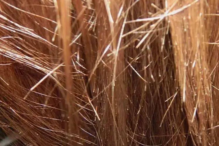 Как лечить секущиеся волосы?