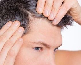 Выпадение волос у мужчин: причины и лечение