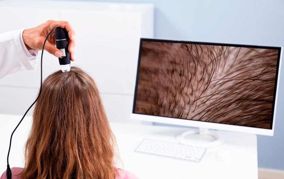 Что такое трихоскопия волос и кожи головы