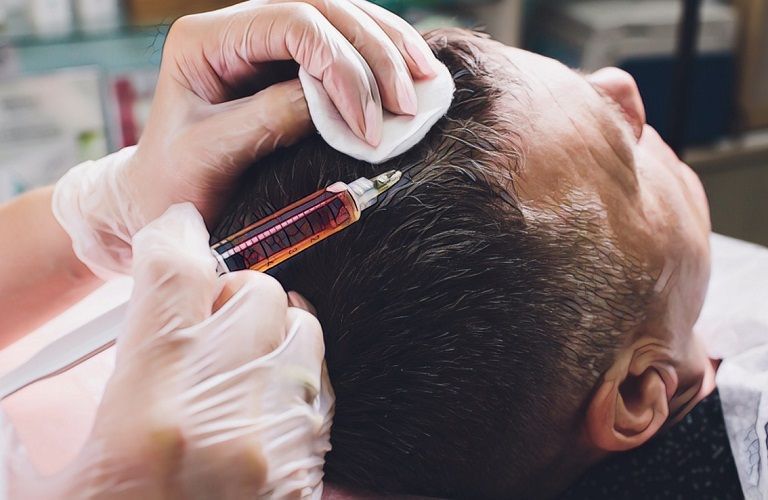 Нужна ли мезотерапия для волос мужчинам