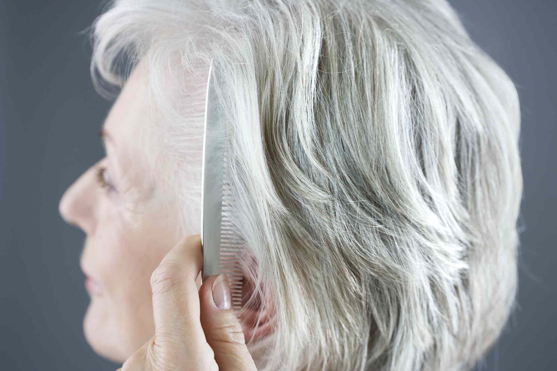 Выпадение волос после 50 лет